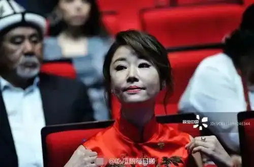  林心如下巴看起来特别可怕,全是一道道坑,无修图简直是恐怖片